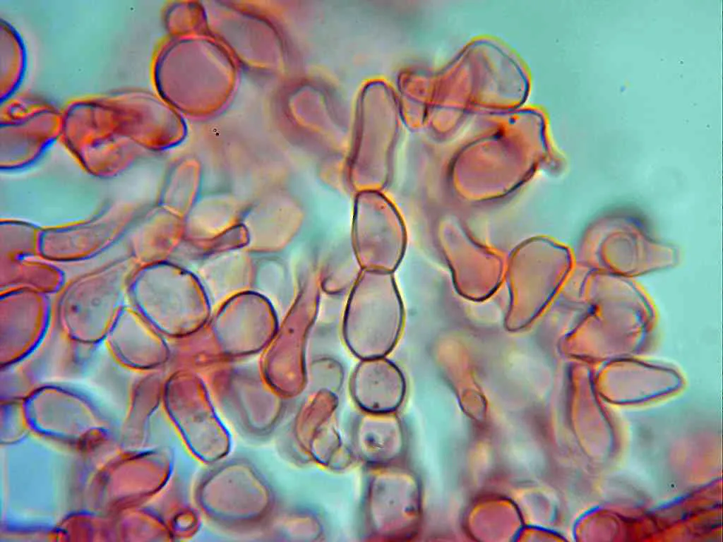 Microscopía de Lycoperdon pratense - 10 - Peridio 1
